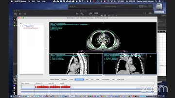 EGSnrc Monte Carlo simulation: Live session 26 Sep 2020