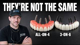 All-on-4 vs 3-on-6 Dental Implants: A Surgeon Performs Both Surgeries (Full Comparison)