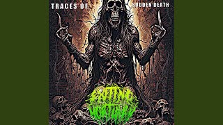 Stealing Parts Of Dissected Cadavers