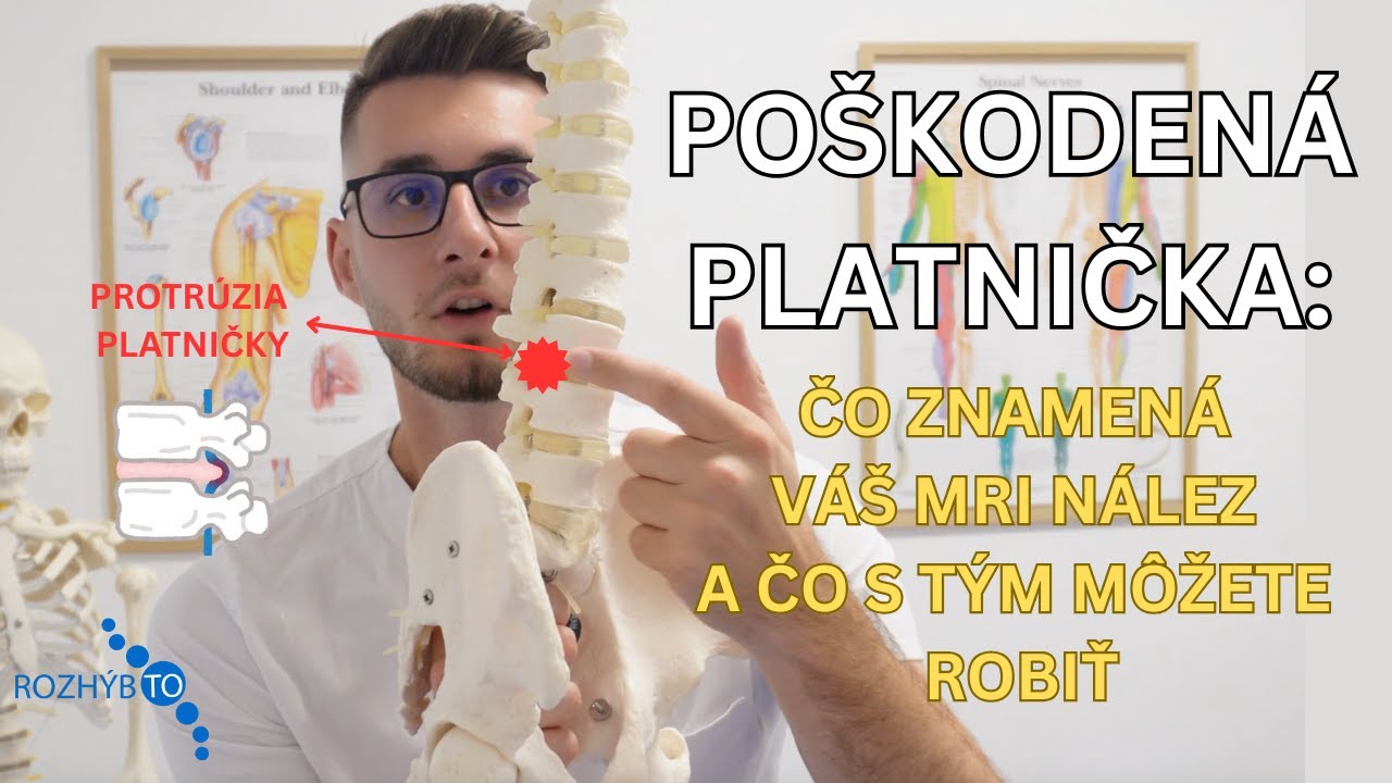 🧑‍⚕️ Poškodené platničky - fázy poškodenia/a ako sa zbaviť bolesti
