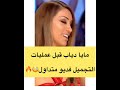 مايا دياب قبل العمليات التجميل    نجومي