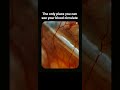 Real view of blood circulation #bloodcirculation #youtube #study #shortfeed #shortvideo #trending
