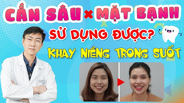 Niềng Răng Điều Trị Khớp Cắn Sâu + Mặt Bạnh Cũng Đơn Giản Với Khay Niềng Răng Trong Suốt
