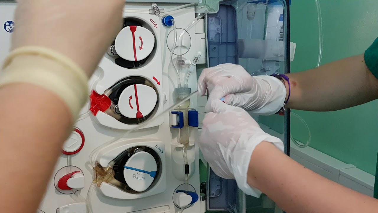 Recogida de muestras de agua. Líquido de infusión y de diálisis