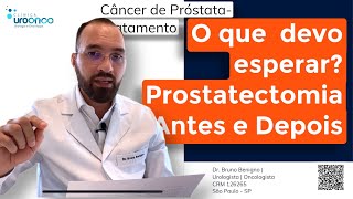 O que você precisa saber sobre o pré e pósoperatório de prostatectomia robótica? Como se preparar?