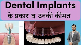 Types & Cost of dental implant | Price of dental implant in India | Dr Ankit Khasgiwala Indore