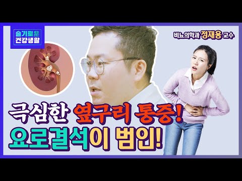 [슬기로운 건강생활] 통증계 삼대장 요로결석의 퇴치법은?(증상과 치료, 자연배출법, 식습관) - 비뇨의학과 정재용 교수