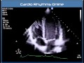 Understanding Echo: Standard Imaging Views