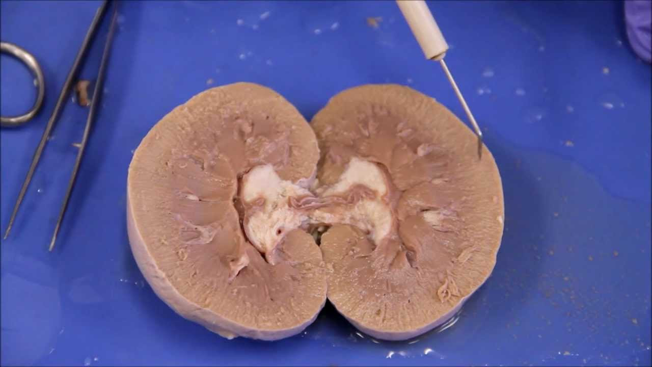 NAU Bio 202 Lab 7 - Sheep Kidney Dissection