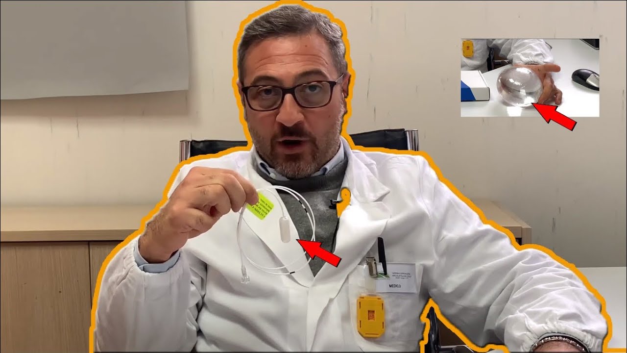 Programma di rieducazione alimentare con palloncino gastrico deglutibile senza intervento