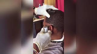 Mid Bald Fade Haircut Transformation At Homesimple...