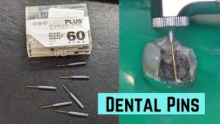 What is a dental pin ?