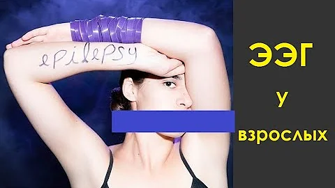 ЭЭГ головного мозга у взрослых. Как подготовиться и что делать при записи электроэнцефалограммы(ЭЭГ)