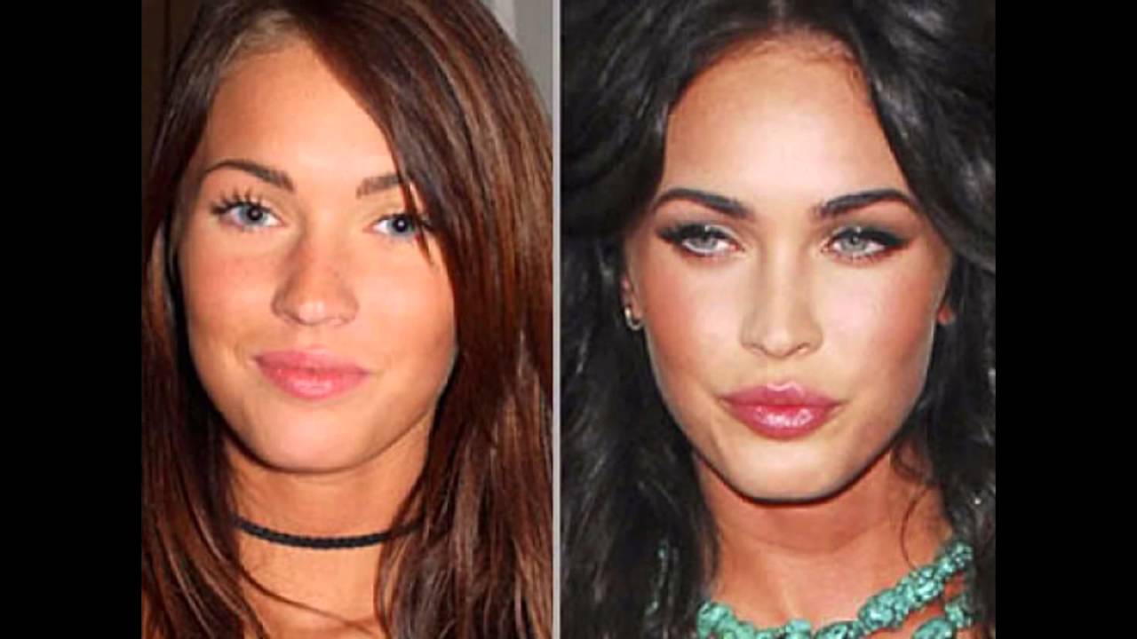 джослин вильденштейн 2022. девушки после пластических операций. дженис дикинсон после пластические операции. джослин вильденштейн 2020. звезды после пластики.