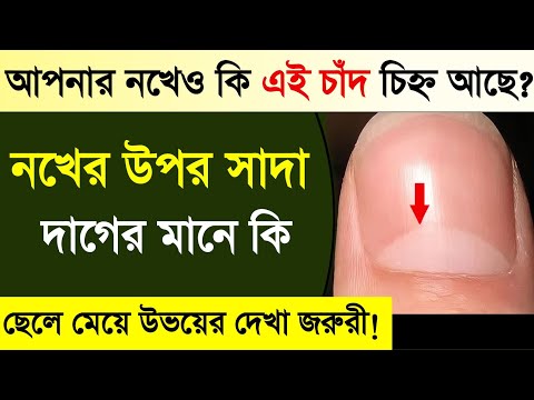 ভিডিও: নীল নদের লাল দাগ কি?