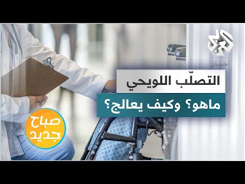 فيديو: هل تصلب يعني؟