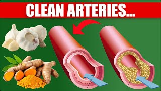 ❣️top 7 foods that unclog arteries naturally and prevent heart attack | how to cook