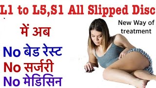 l4-l5, l5-s1 disc bulge treatment without surgery | No bed rest | No exercise | fast recovery