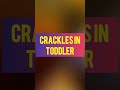 Crackles in toddler