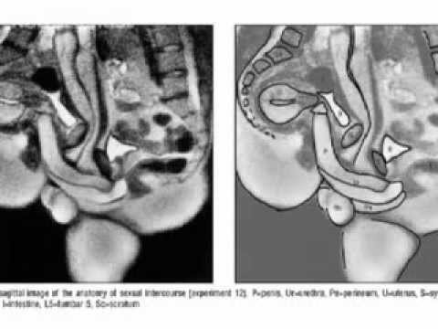 Mri Scan Of Sex 71