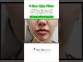 Clim Clinic, BEFORE AFTER of REJUVIEL