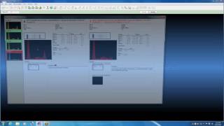 Myeloma Module Software