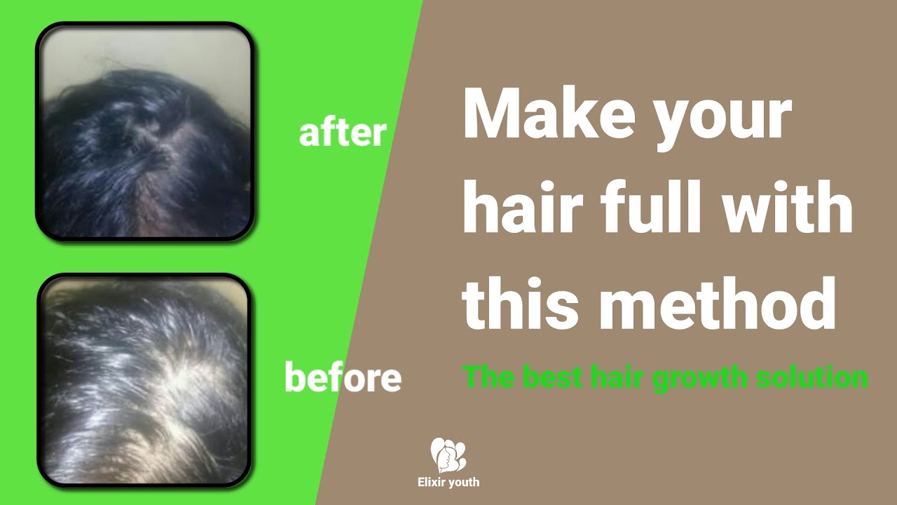 100 natural home remedy for hair loss/hair regrowth YouTube