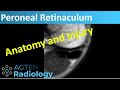 Superior Peroneal Retinaculum - MRI Anatomy and Injuries