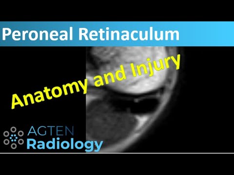 Video: Superior Peroneal Retinaculum Anatomy, Function & Diagram - Kroppskartor