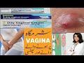 clotrimazole vaginal cream | vaginal antifungal cream uses in Urdu | 3 day vaginal cream #mishal