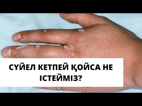 Бейне: Суккотты қалай тойлау керек (Шатыр мерекесі): 15 қадам