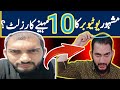 Famous youtuber ka 10 months result  hair transplant clinics in pakistan  hair transplant cost 