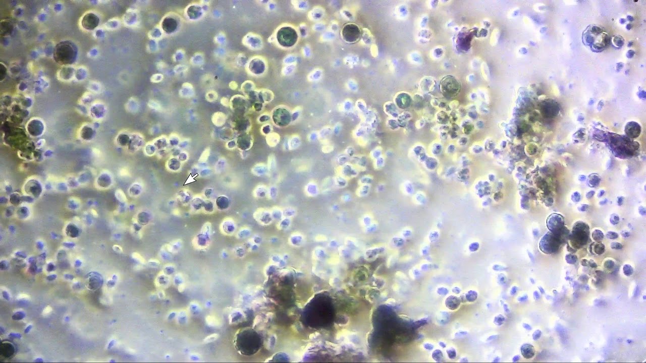 Peat Plug Microscope Apocalypse...