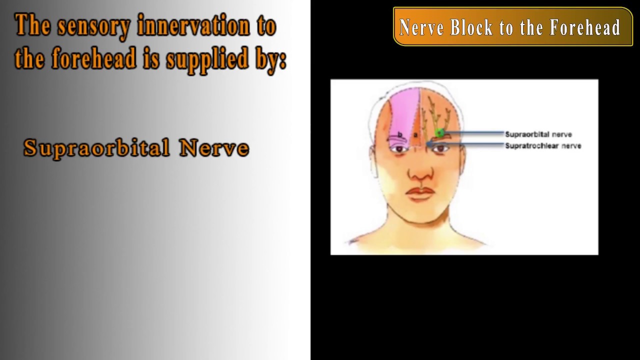 Nerveblock to the Forehead - YouTube