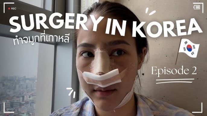 I Got A Nose Job In Korea! Best Decision Ever! | Vlog & In-Depth Review  (Full Experience) - Youtube