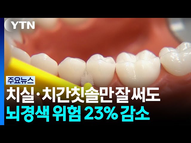 "치실·치간칫솔만 잘 써도 뇌경색 위험 23% 감소" / YTN