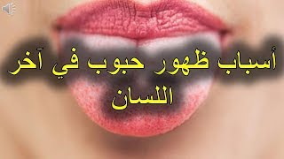 أسباب ظهور حبوب في آخر اللسان