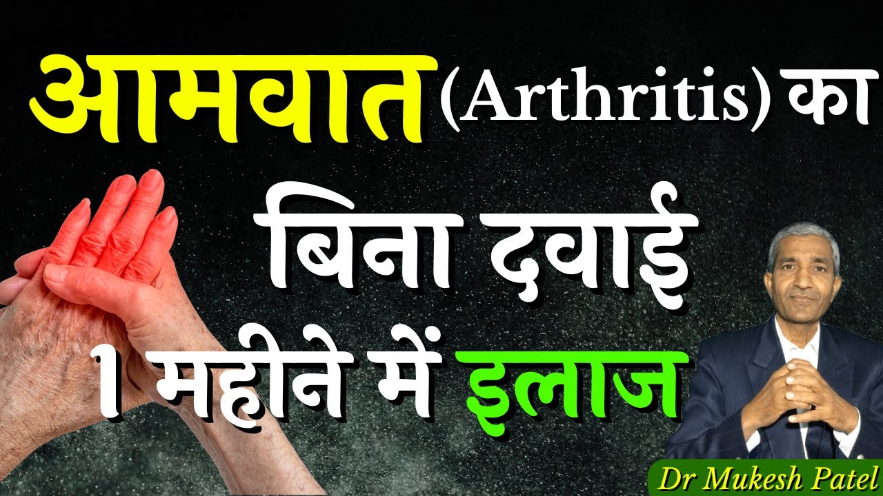 आमवात(Arthritis) का जड़ से इलाज | Arthritis(Aamvat) ka Jad se ilaj | SvaTantr