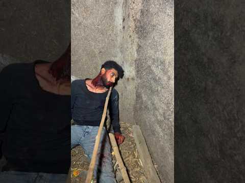 My Friend Is Turning Into A Zombie Because Of The Virus