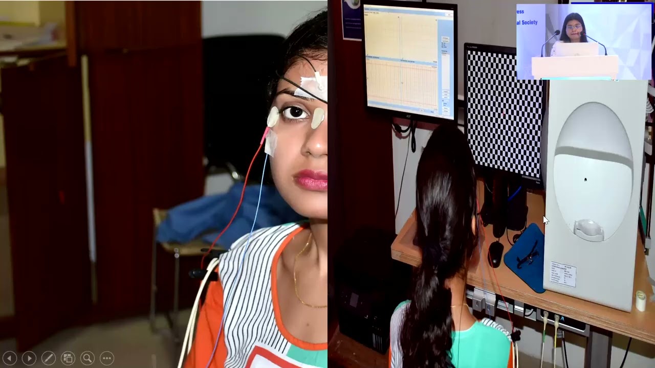 AIOS2025 IC282 T Dr Bibhuti B  KASHYAP Pattern ERG