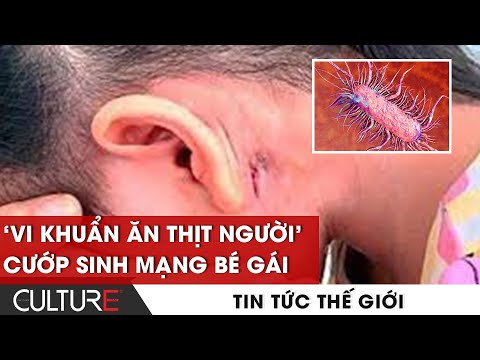 Video: Terrance West đang nộp đơn kiện vì anh ta bị cướp… hai lần… tại cùng một nơi… trong cùng một ngày