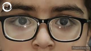 High myopia in children