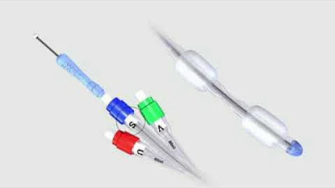 Cook® Cervical Ripening Balloon