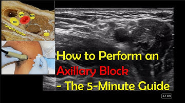 Axillary Block – A "How-To" Guide