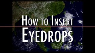 HOW TO USE EYE DROPS ?? PROPER METHOD| GUIDE | PATIENT INFORMATION AND LEARNING from EXPERT HOW TO USE EYE DROPS ?? PROPER METHOD| GUIDE | PATIENT INFORMATION AND LEARNING from EXPERT