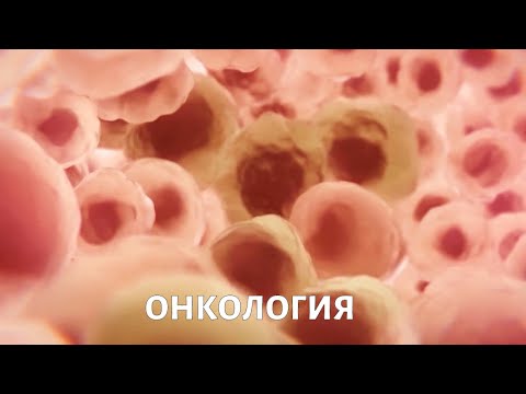 Метод исследования: онкология