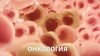 Метод исследования: онкология