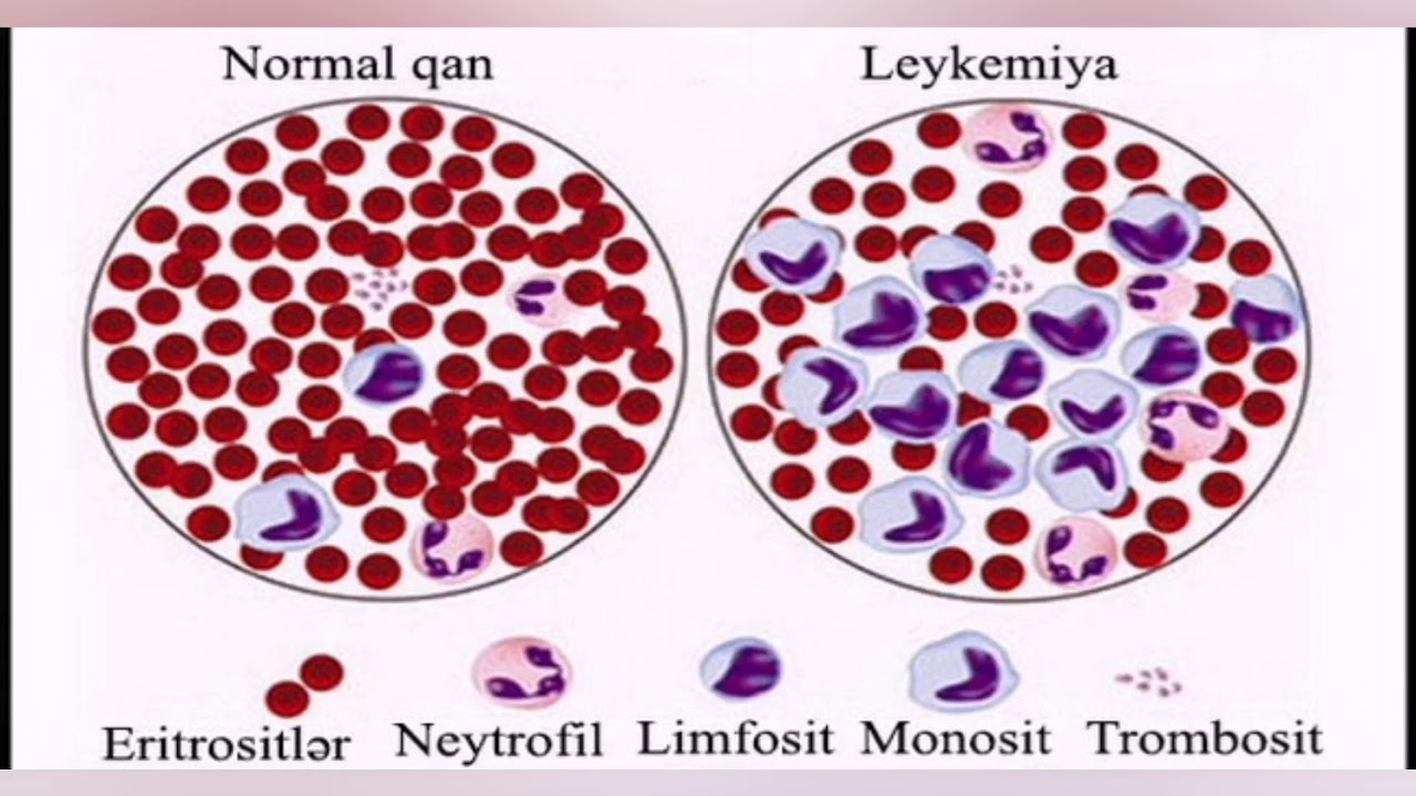 Qan qrupları, Qan xəstəlikləri və qanla yoluxan xəstəliklər
