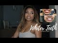 How to get whiter teeth with smile brilliant  giveaway