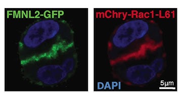 biosights: May 11, 2015 - Formin